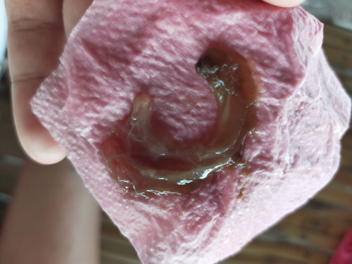 มีมูกเลือด