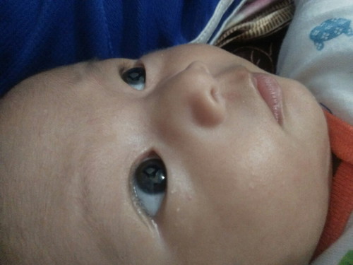 bintik putih kecil dibawah mata seperti jerawat uda lama gk hilang2