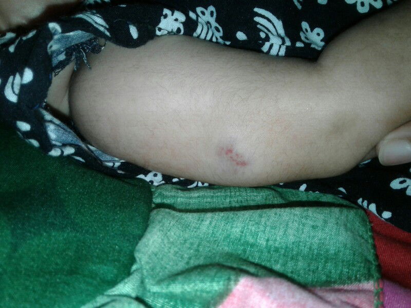 kulit bayi
