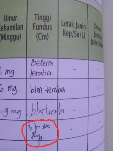 kolom tinggi fudus