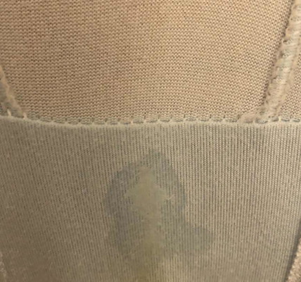 อาการน้ำคร่ำรั่วเป็นอย่างไรคะ มีน้ำออกมาเยอะน้อยแค่ไหน