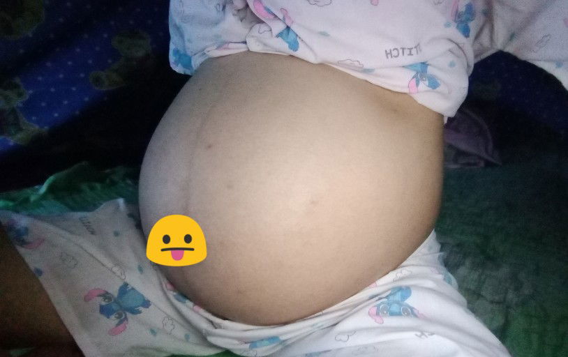 ยังไม่มีวี่แววจะคลอด