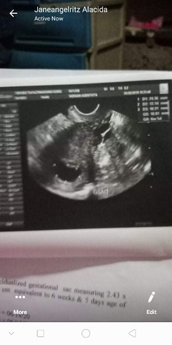 ultrasound
