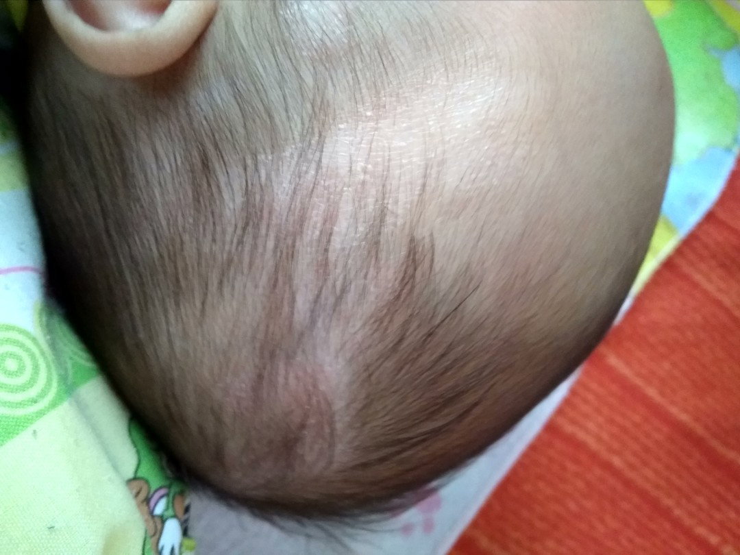 Kulit kering dan merah2