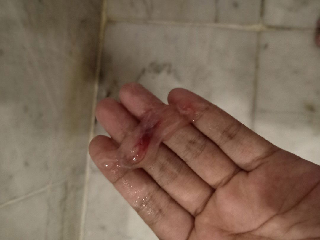 Lendir bercampur darah