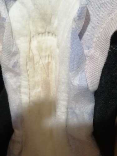 Brownish Discharge