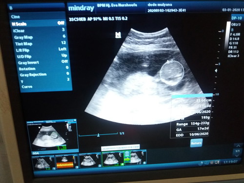 16W3D