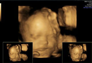 Terima kasih, Kuucapkan~