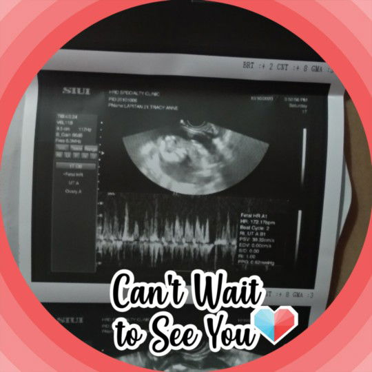 Tracy anne Lapitan profile icon