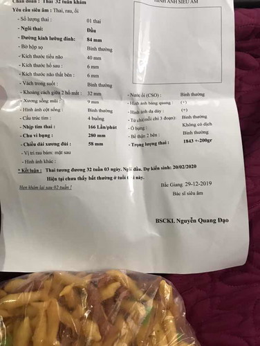32 tuần 3 ngày