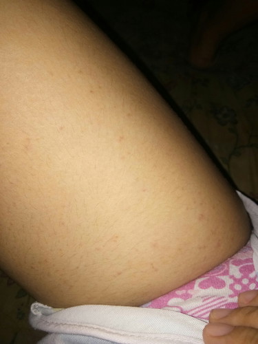 bungang araw?