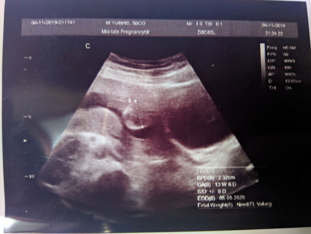 Bagi pengalamannya dong bunda