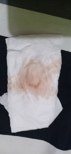 brown discharge @ 35 weeks