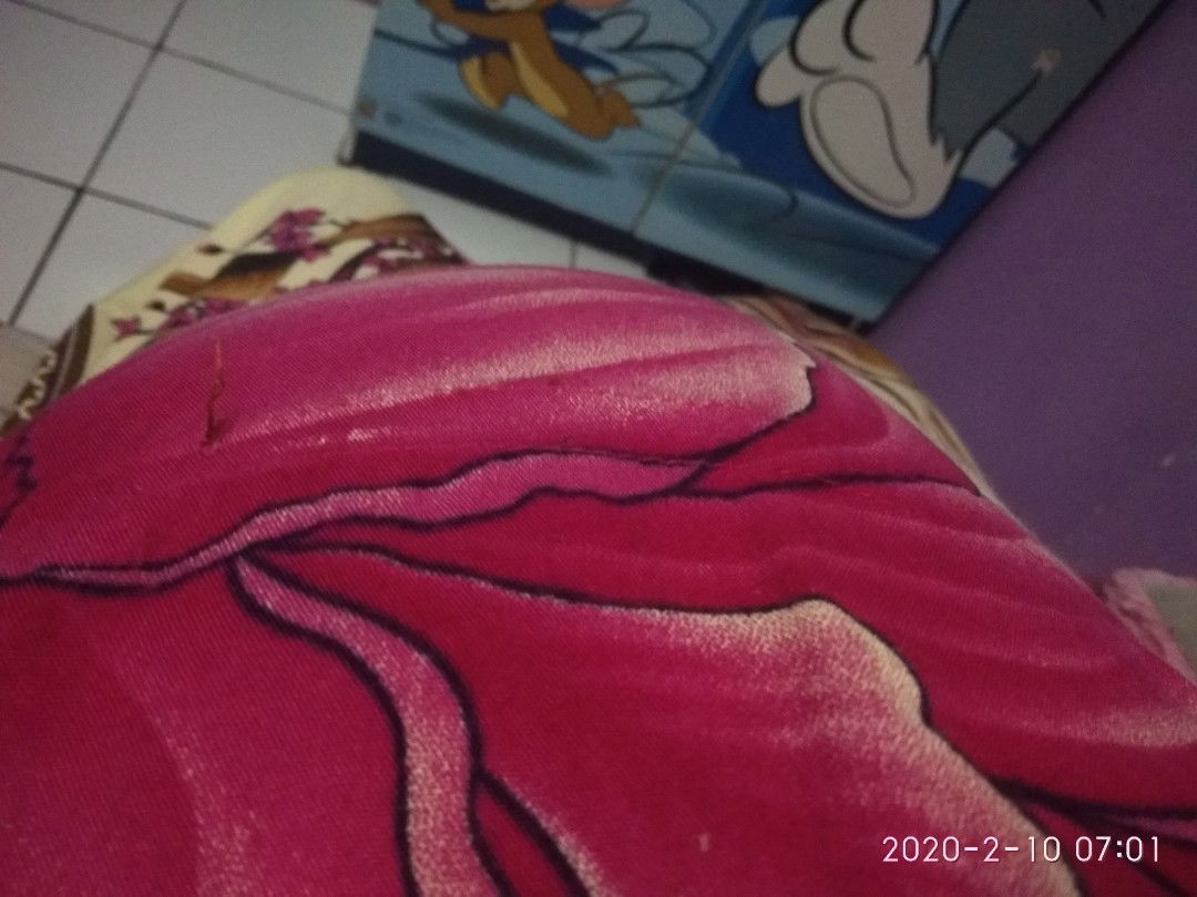 Menanti Kelahiran .. 37w2d