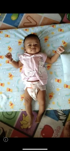 น้องชอบเกร็งขา 2m 25d