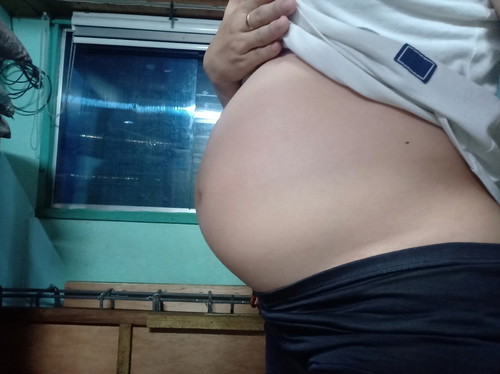 BUMP at 26 Weeks ?