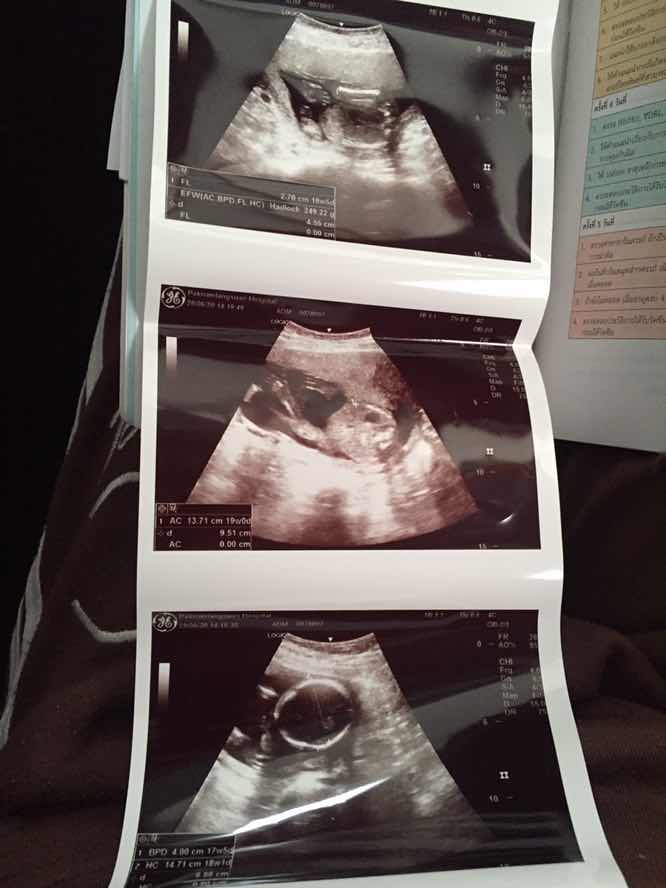 ช่วยดูหน่อยคะ