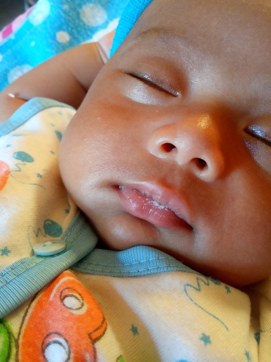 putih2 di lidah dan bibir