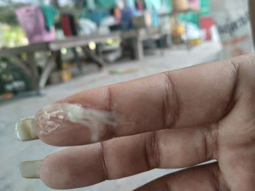 ท้องได้38วีคมีมูกออกมา