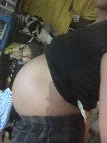 1cm / 37weeks / fTM / 2.8kg