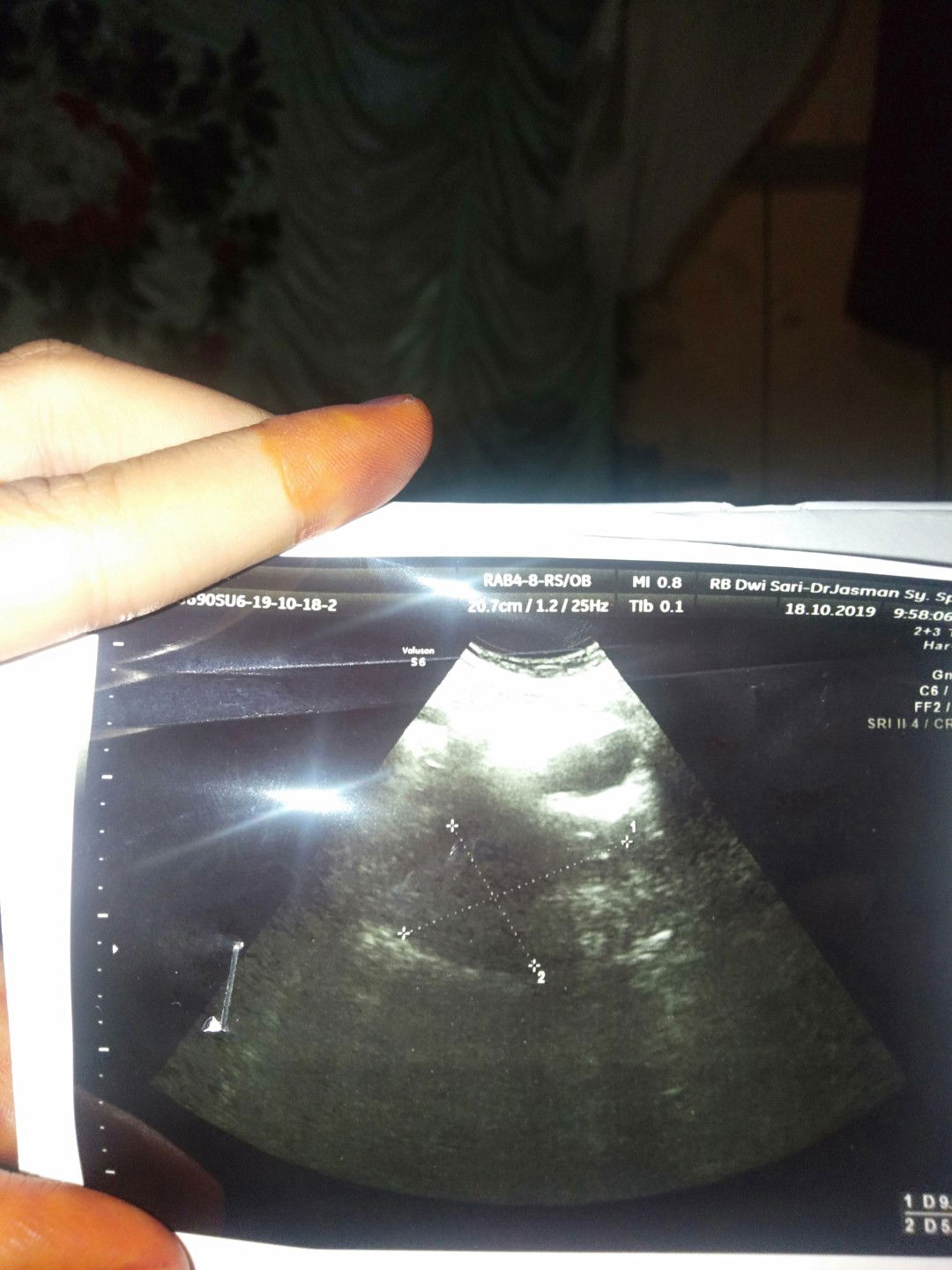 penebalan dinding rahim