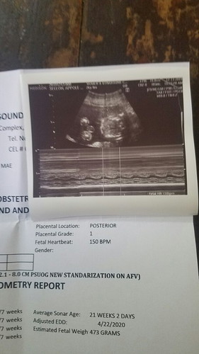 ultrasound