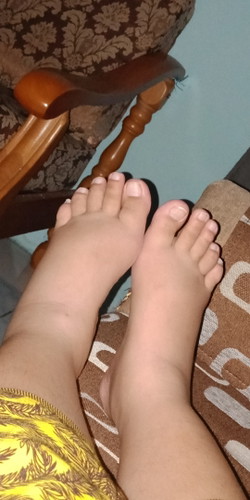 kaki bengkak