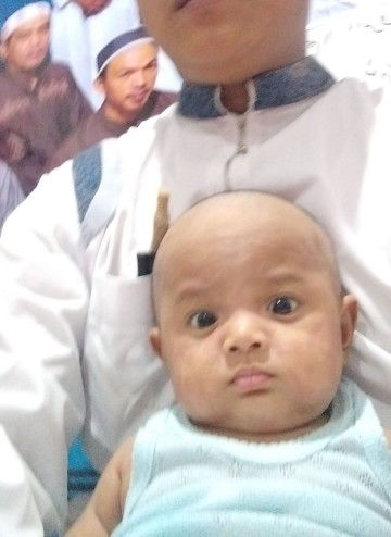 kerumut atau campak/alergi