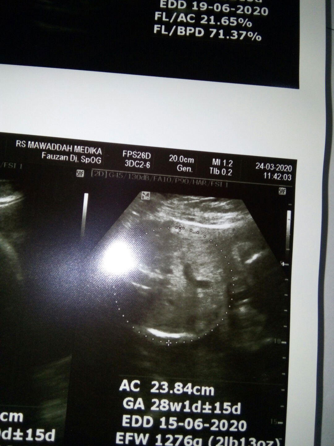 ari² menutup jalan lahir