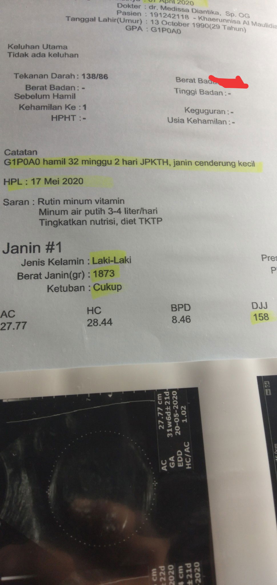 janin cenderung kecil