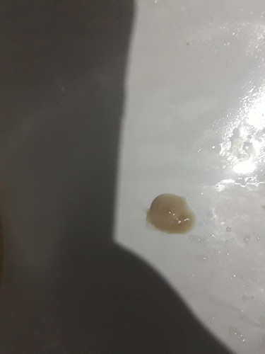 mucus plug po ba ito?