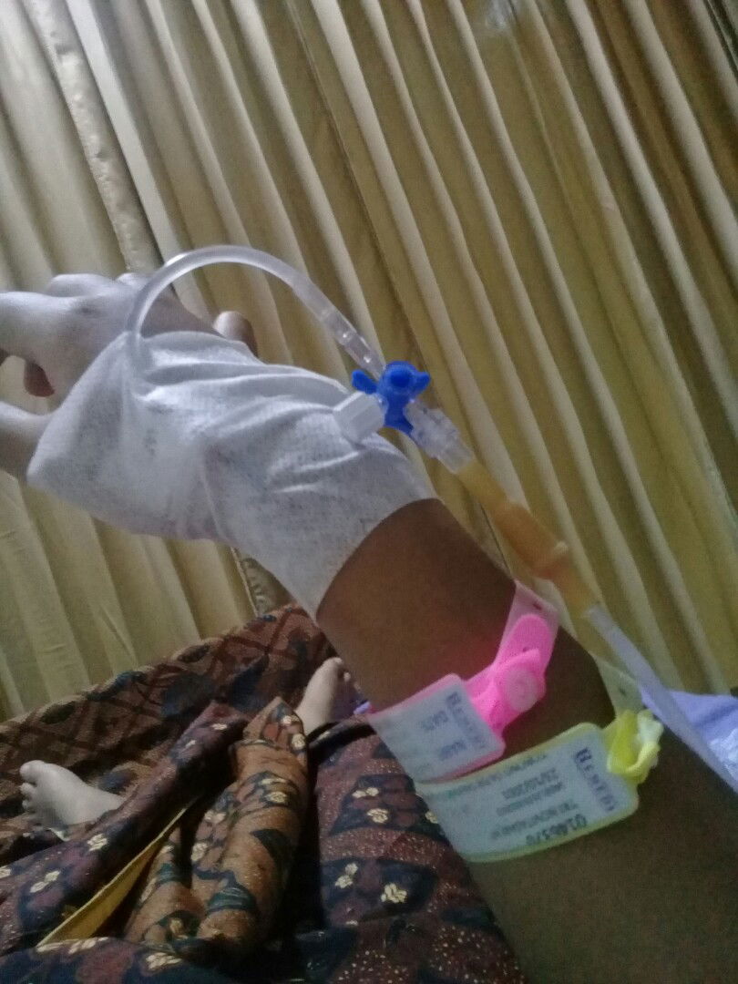 ketuban pecah duluan