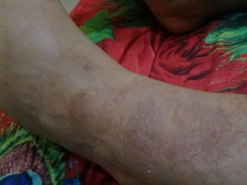 curhat suami kata uda nggk peduli sma penyakitku??