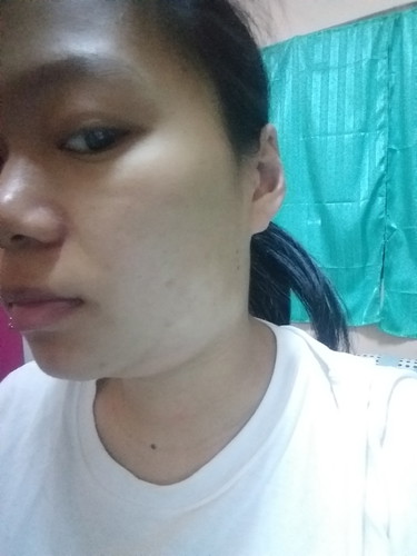 ปวดฟันตอนท้อง