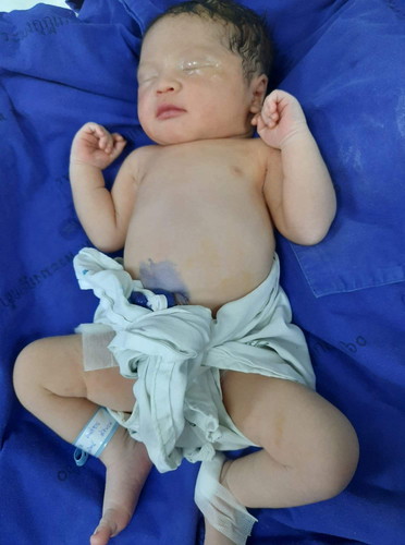 แตกแล้ววันนี้ น้อง ขุน 2.8 kg ( 38+3)