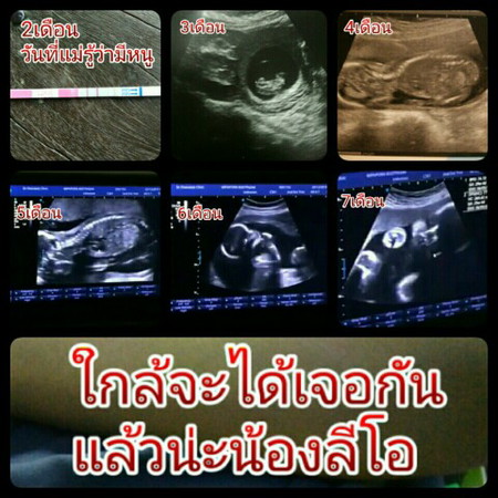ความทรงจำ