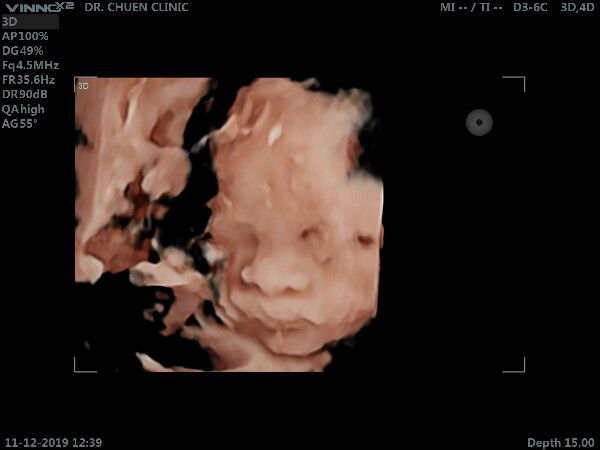 baby girls profile icon