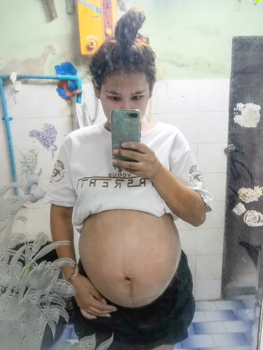 37w 1d