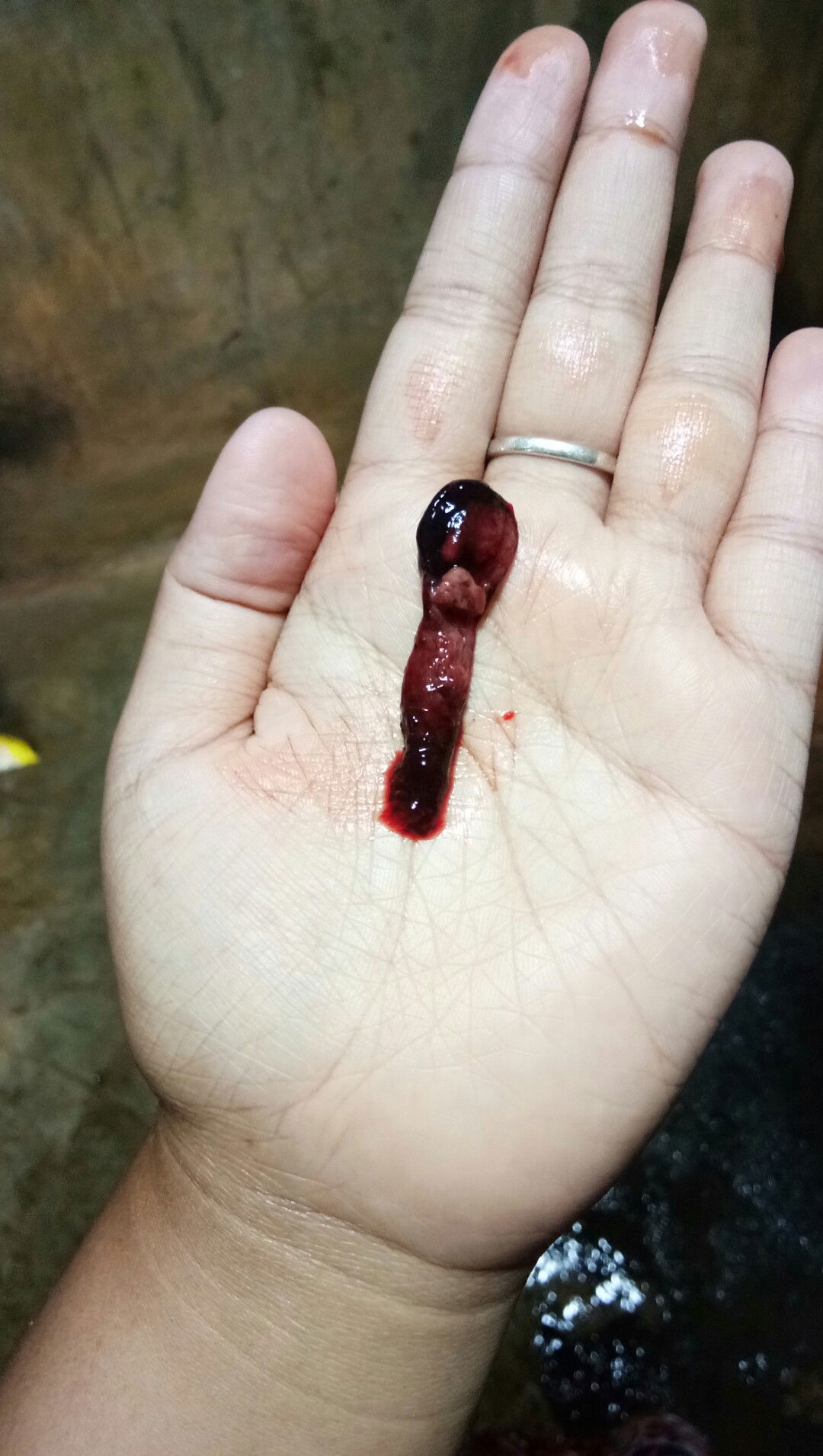 keluar gumpalan seperti daging saat haid