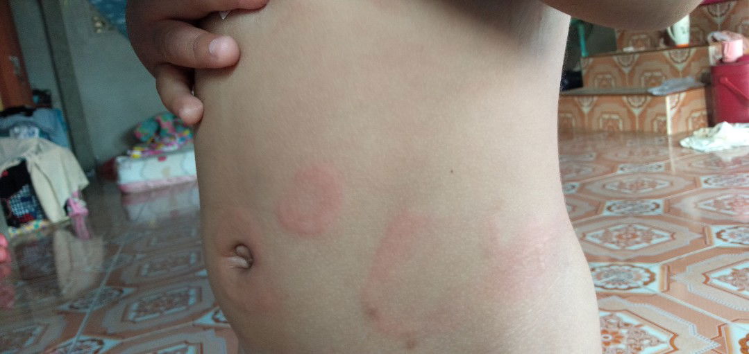 หมอบอกน้ำเหลืองไม่ดี แต่ในช่องโควิด หมอไม่เข้าใกล้คนไข้เลย