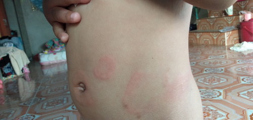 หมอบอกน้ำเหลืองไม่ดี แต่ในช่องโควิด หมอไม่เข้าใกล้คนไข้เลย