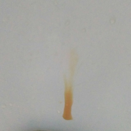 Cs last June 1, normal Lang po ba tong discharge