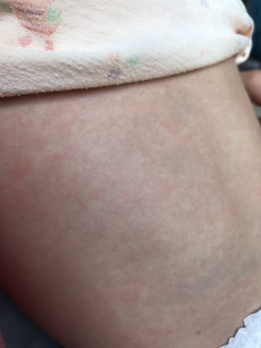 หัดหรือป่าวคะ