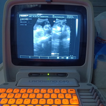 Ultrasound