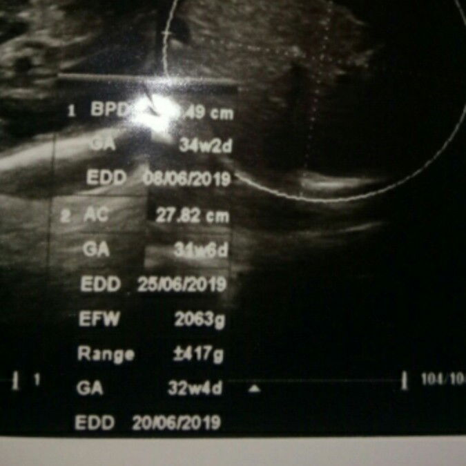 mau tanya dong bun,,,