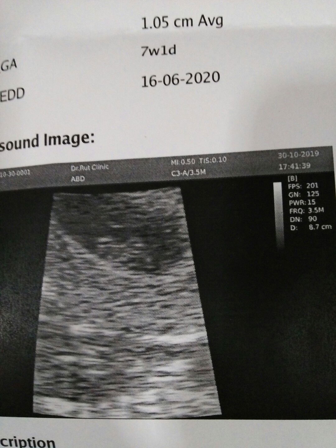 ดีใจจัง