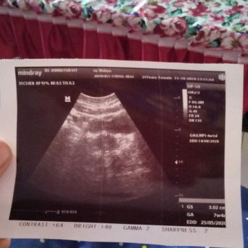 menghitung usia kehamilan