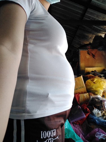 อยากทราบค่ะ ท้องเเรก14สัปดาห์ ท้องใหญ่ไปไหมค่ะรึว่าปกติค่ะ