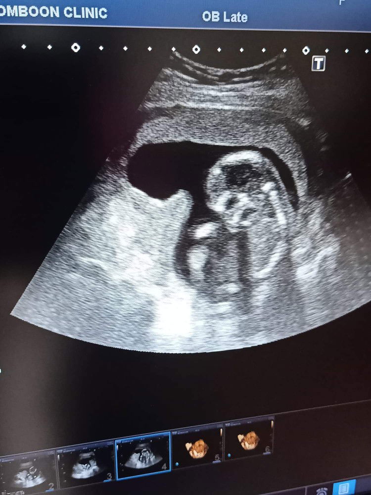 หมิว profile icon