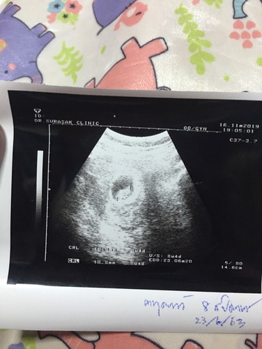 ซาว8วีค